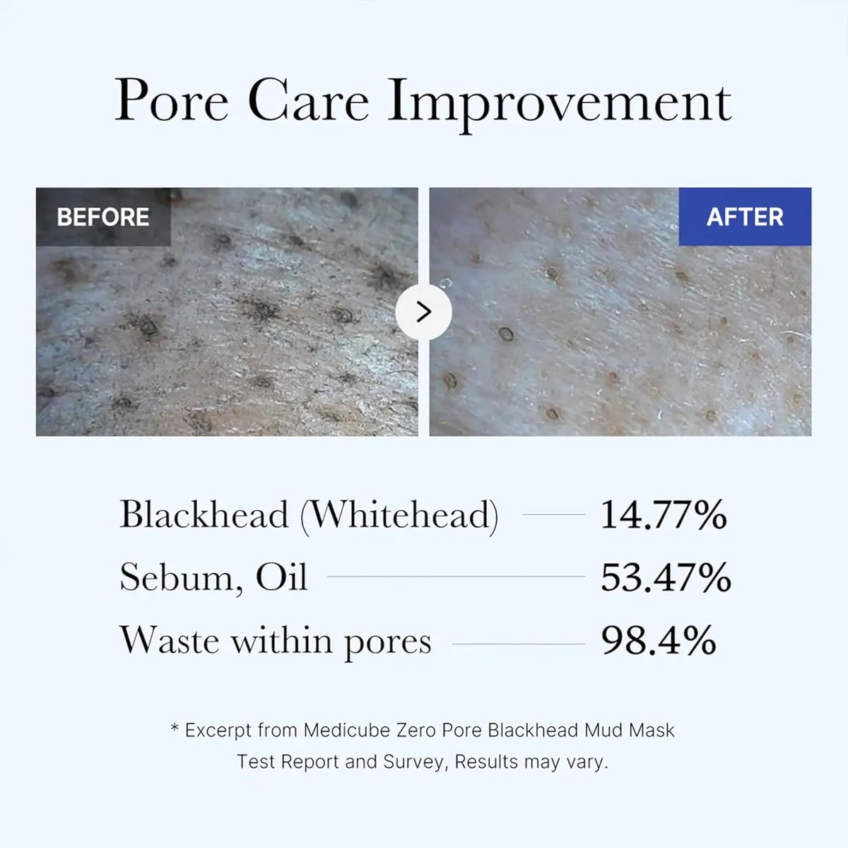 Medicube Zero Pore Blackhead Mud Mask 100G