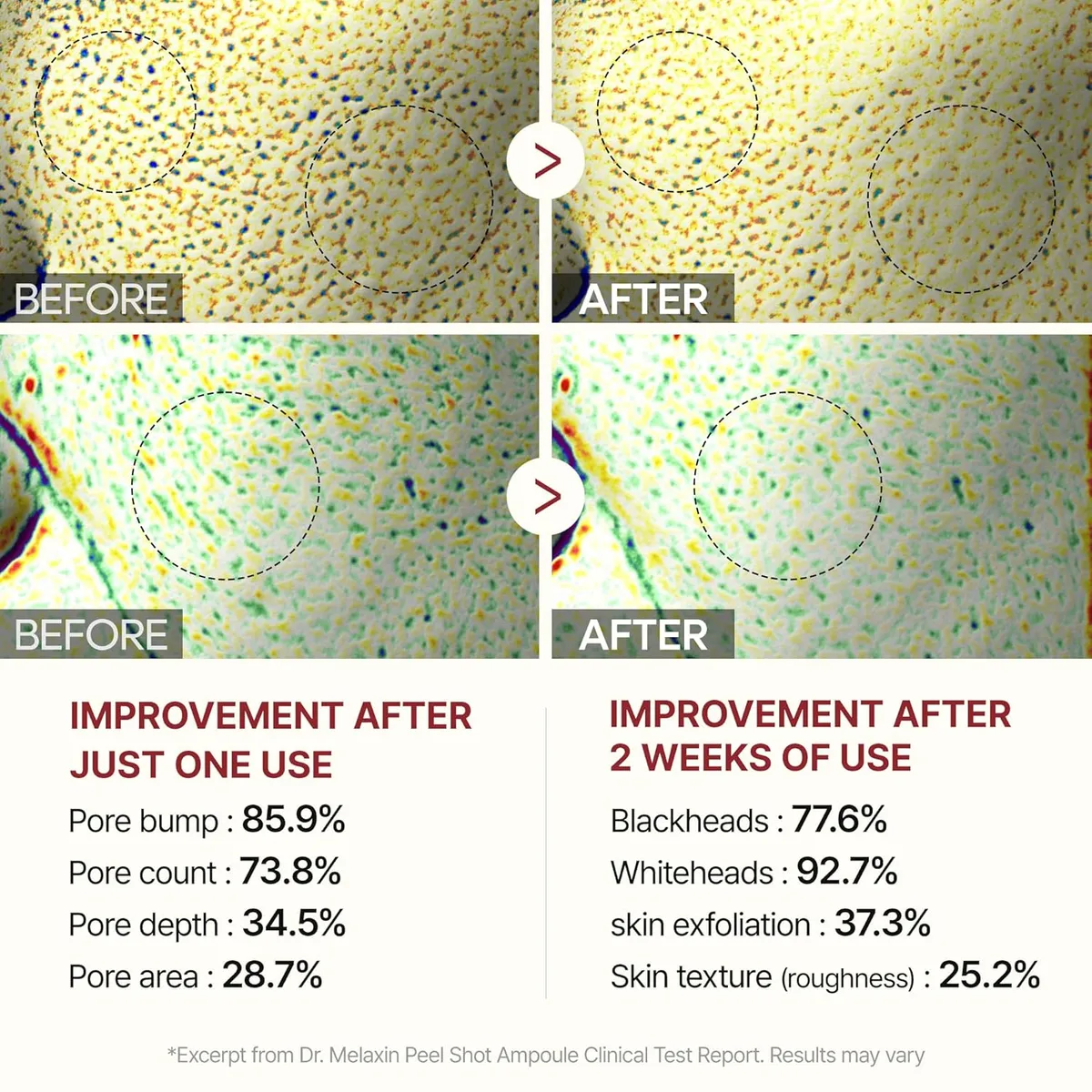 Dr.Melaxin Peel Shot Glow Black Rice Peeling Ampoule 80ml