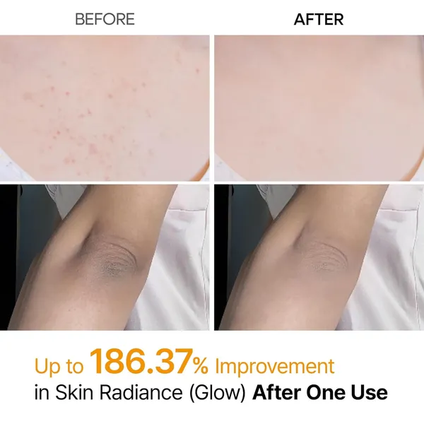 Dr.Melaxin Body Keratin Care Kojic Acid 200ml