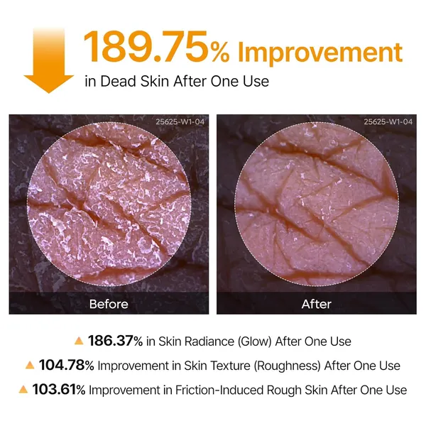 Dr.Melaxin Body Keratin Care Kojic Acid 200ml