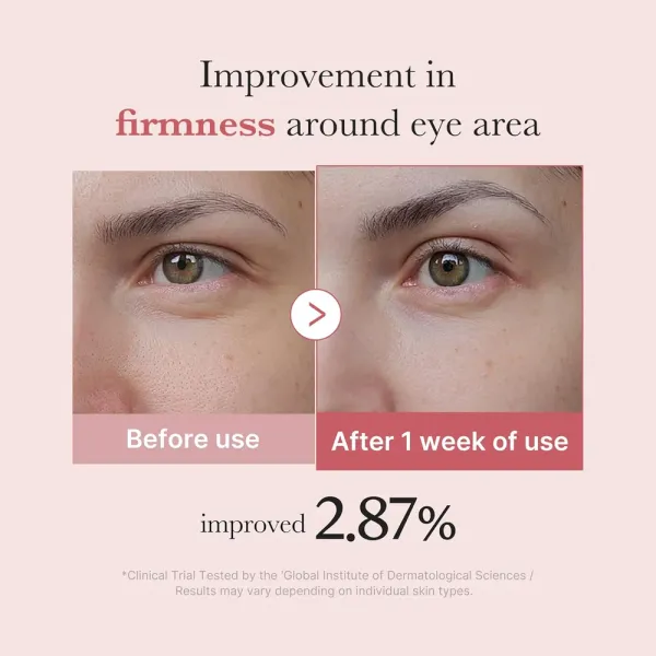 Medicube PDRN Pink Peptide Eye Cream 30 ml